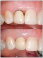 /album/periodontics/periodontics-6-jpg/